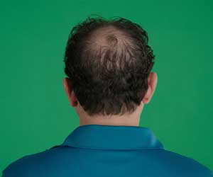 Hair Grow Max 2x1 a 49,99€