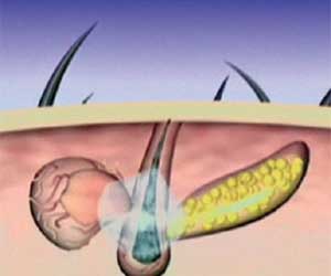 Hair Grow Max 2x1 a 1.261 CZK